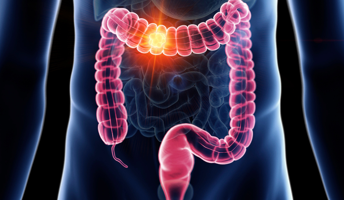 Gut Health & Detox
